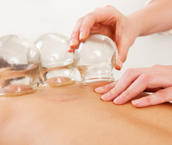 Is Cupping good for health?